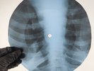 ROLLING STONES SYMPATHY FOR DE X-Ray USSR Record Roentgen Bones Ribs Music Vinyl