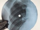 ROLLING STONES DOWN HOME GIRL X-Ray USSR Record Roentgen Bones Ribs Music Vinyl