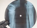BLACK SABBATH BLACK SABBATH X-Ray USSR Record Roentgen Bones Ribs Music Vinyl