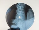 BEATLES ELEANOR RIGBY X-Ray USSR Record Roentgen Bones Ribs Music Vinyl