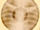 X-RAY USSR ROENTGEN BONES RECORD ORIGINAL OLD RIBS 692