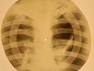 X-RAY USSR ROENTGEN BONES RECORD 78 rpm ORIGINAL OLD RIBS 735