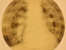 X-RAY USSR ROENTGEN BONES RECORD 78 rpm ORIGINAL OLD RIBS 709