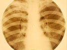 X-RAY USSR ROENTGEN BONES RECORD ORIGINAL OLD RIBS 678