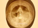 USSR X-RAY SKULL metal teeth ROENTGEN BONES RECORD ORIGINAL OLD RIBS 690