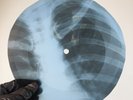 SINATRA DONT LIKE GOODBYES X-Ray USSR Record Roentgen Bones Ribs Music Vinyl
