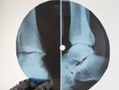 DAVID BOWIE SUPERMAN X-Ray USSR Record Roentgen Ribs Bone Music Vinyl