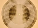 X-RAY USSR ROENTGEN BONES RECORD 78 rpm ORIGINAL OLD RIBS 751