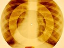 X-RAY USSR ROENTGEN BONES RECORD 78 rpm ORIGINAL OLD RIBS 768