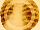 X-RAY USSR ROENTGEN BONES RECORD 78 rpm ORIGINAL OLD RIBS 769