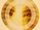 X-RAY USSR ROENTGEN BONES RECORD 78 rpm ORIGINAL OLD RIBS 752