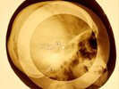 USSR X-RAY SKULL ROENTGEN BONES RECORD ORIGINAL OLD RIBS 766