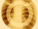 X-RAY USSR ROENTGEN BONES RECORD 78 rpm ORIGINAL OLD RIBS 764