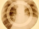 X-RAY USSR ROENTGEN BONES RECORD ORIGINAL OLD RIBS 765
