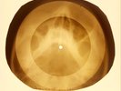 USSR X-RAY SKULL ROENTGEN BONES RECORD ORIGINAL OLD RIBS 781
