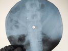 LED ZEPPELIN BLACK DOG X-Ray USSR Record Roentgen Bone Ribs Music Vinyl