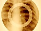 X-RAY USSR ROENTGEN BONES RECORD ORIGINAL OLD RIBS 780