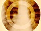 X-RAY USSR ROENTGEN BONES RECORD ORIGINAL OLD RIBS 788