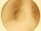 X-RAY USSR ROENTGEN BONES RECORD ORIGINAL OLD RIBS 628