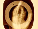 Broken finger USSR X-RAY HAND ROENTGEN BONES RECORD ORIGINAL OLD RIBS 793