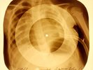 X-RAY USSR ROENTGEN BONES RECORD 78 rpm ORIGINAL OLD RIBS 826