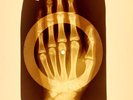 X-RAY USSR ROENTGEN BONES RECORD 78 rpm ORIGINAL OLD RIBS 821
