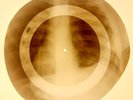 X-RAY USSR ROENTGEN BONES RECORD 78 rpm ORIGINAL OLD RIBS 839