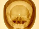 USSR X-RAY SKULL ROENTGEN BONES RECORD ORIGINAL OLD RIBS 840