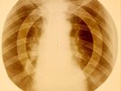 X-RAY USSR ROENTGEN BONES RECORD 78 rpm ORIGINAL OLD RIBS 844