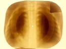 X-RAY USSR ROENTGEN BONES RECORD 78 rpm ORIGINAL OLD RIBS 838