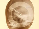USSR X-RAY SKULL ROENTGEN BONES RECORD ORIGINAL OLD RIBS 850