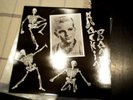 1 x UK LP Ronnie Dawson Rockin Bones  No Hit  Records