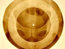 X-RAY USSR ROENTGEN BONES RECORD ORIGINAL OLD RIBS 819