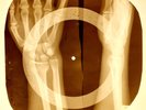 USSR X-RAY HANDS ROENTGEN BONES RECORD ORIGINAL OLD RIBS 802