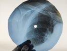 F. SINATRA SILENT NIGHT X-Ray USSR Record Roentgen Bone Ribs Music Vinyl