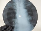 PINK FLOYD LUCIFER SAM X-Ray USSR Record Roentgen Bones Ribs Music Vinyl