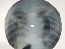 BEATLES WITHIN YOU WITHOUT YOU X-Ray USSR Record Roentgen Bones Ribs Music Vinyl