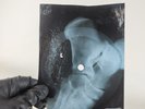 LED ZEPPELIN IMMIGRANT SONG X-Ray USSR Record Roentgen Bones Ribs Music Vinyl