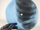 ROLLING STONES RUBY TUESDAY X-Ray USSR Record Roentgen Bones Ribs Music Vinyl