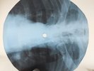 VELVET UNDERGROUND ROCK&ROLL X-Ray USSR Record Roentgen Bones Ribs Music Vinyl