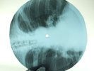 DOORS LIGHT MY FIRE X-Ray USSR Record Roentgen Bones Ribs Music Vinyl