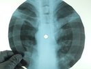 BEATLES OH DARLING X-Ray USSR Record Roentgen Bones Ribs Music Vinyl