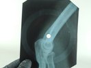 BEATLES I'VE JUST SEEN A FACE  X-Ray USSR Record Roentgen Bones Ribs Music Vinyl