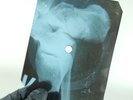 BOB DYLAN OXFORD TOWN X-Ray USSR Record Roentgen Bones Ribs Music Vinyl