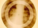 X-RAY USSR ROENTGEN BONES RECORD ORIGINAL OLD RIBS 809