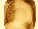 X-RAY USSR ROENTGEN CHILD BONES RECORD ORIGINAL OLD RIBS 837