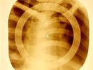 X-RAY USSR ROENTGEN BONES RECORD ORIGINAL OLD RIBS 804