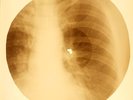 X-RAY USSR ROENTGEN BONES RECORD ORIGINAL OLD RIBS 571