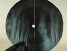 BOB DYLAN POSITIVELLY 4TH ST X-Ray USSR Record Roentgen Bones Ribs Music Vinyl