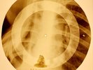 X-RAY USSR ROENTGEN BONES RECORD ORIGINAL OLD RIBS 867